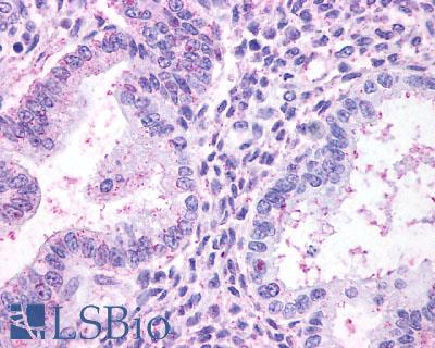 Anti-TBXA2R antibody LS-A1280 IHC of human uterus. Immunohistochemistry of formalin-fixed, paraffin-embedded tissue after heat-induced antigen retrieval.