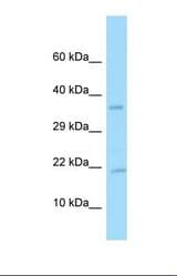 Western blot of Human U937. PDGFA antibody dilution 1.0 ug/ml.