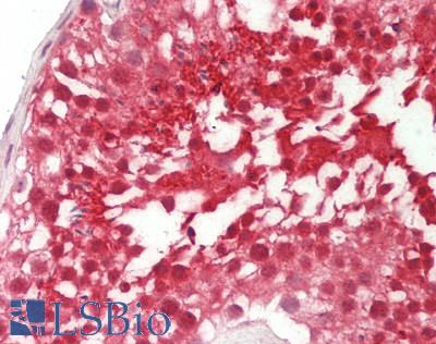 Human Testis: Formalin-Fixed, Paraffin-Embedded (FFPE)