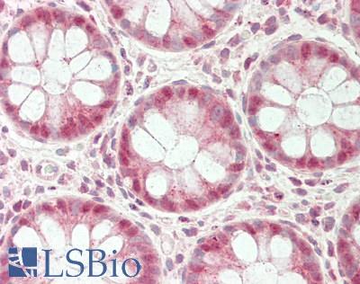 Human Colon: Formalin-Fixed, Paraffin-Embedded (FFPE)