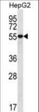 UGDH Antibody western blot of HepG2 cell line lysates (35 ug/lane). The UGDH antibody detected the UGDH protein (arrow).