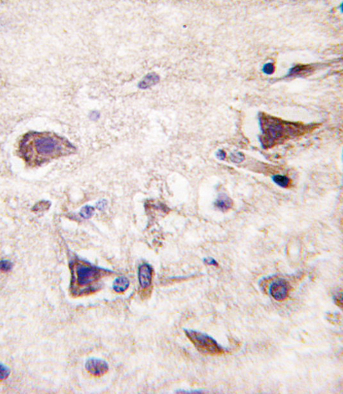 Formalin-fixed and paraffin-embedded human brain tissue reacted with PDGFA antibody , which was peroxidase-conjugated to the secondary antibody, followed by DAB staining. This data demonstrates the use of this antibody for immunohistochemistry; clinical relevance has not been evaluated.