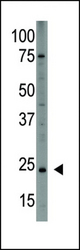 The anti-PDGFA is used in Western blot to detect PDGFA in HL60 cell lysate.