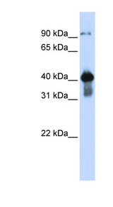 USF2 antibody LS-C112153 Western blot of Transfected 293T cell lysate.