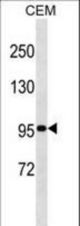 USP1 Antibody western blot of CEM cell line lysates (35 ug/lane). The USP1 antibody detected the USP1 protein (arrow).