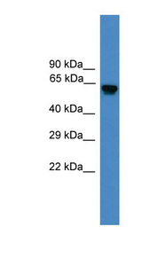 USP17L2 / DUB3 antibody LS-C116937 Western blot of Fetal Heart lysate.