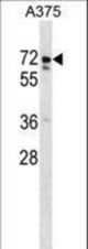 USP17L2 Antibody western blot of A375 cell line lysates (35 ug/lane). The USP17L2 antibody detected the USP17L2 protein (arrow).