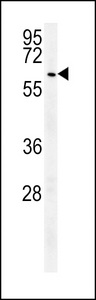 USP17 Antibody western blot of HepG2 cell line lysates (35 ug/lane). The USP17 antibody detected the USP17 protein (arrow).