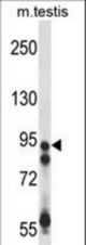 USP20 Antibody western blot of mouse testis tissue lysates (35 ug/lane). The USP20 antibody detected the USP20 protein (arrow).