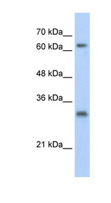 USP39 antibody LS-B1114 Western blot of HepG2 cell lysate.