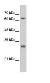 HepG2 Cell Lysate
