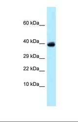 Western blot of Human Jurkat . USP4 antibody dilution 1.0 ug/ml.