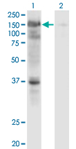 Western Blot analysis of USP4 expression in transfected 293T cell line by USP4 monoclonal antibody (M01), clone 5E12.Lane 1: USP4 transfected lysate (Predicted MW: 108.6 KDa).Lane 2: Non-transfected lysate.