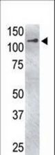 The anti-USP4 C-term antibody is used in Western blot to detect USP4 in USP4-transfected HeLa cell lysate. Transfection data is kindly provided by Dr. B. Pierrat from the Novartis Institute for Biomedical Research (Basel, Switzerland).