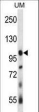 USP4 Antibody western blot of human uterine tumor tissue lysates (35 ug/lane). The USP4 antibody detected the USP4 protein (arrow).