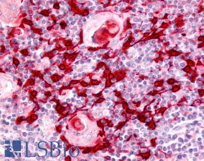 Anti-USP4 antibody LS-A8564 IHC of human thymus. Immunohistochemistry of formalin-fixed, paraffin-embedded tissue after heat-induced antigen retrieval.