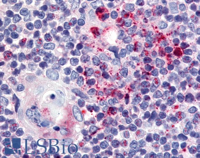 Anti-USP4 antibody LS-A8558 IHC of human thymus. Immunohistochemistry of formalin-fixed, paraffin-embedded tissue after heat-induced antigen retrieval.