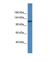 Western blot of Human Jurkat. USP6 antibody dilution 1.0 ug/ml.