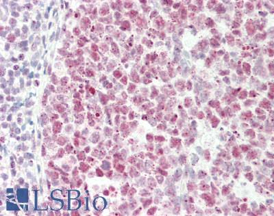 Human Tonsil: Formalin-Fixed, Paraffin-Embedded (FFPE)