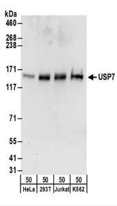 Detection of Human USP7 by Western Blot. Samples: Whole cell lysate (50 ug) from HeLa, 293T, Jurkat, and K562 cells. Antibodies: Affinity purified rabbit anti-USP7 antibody used for WB at 1 ug/ml. Detection: Chemiluminescence with an exposure time of 30 seconds.