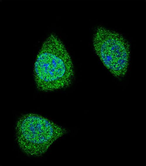 Confocal immunofluorescent of PDGFB Antibody with 293 cell followed by Alexa Fluor 488-conjugated goat anti-rabbit lgG (green). DAPI was used to stain the cell nuclear (blue).