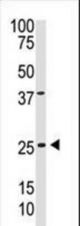 The anti-PDGFB C-term antibody is used in Western blot to detect PDGFB in A375 cell lysate.