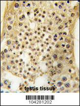 Formalin-fixed and paraffin-embedded human testis tissue reacted with USP7 antibody , which was peroxidase-conjugated to the secondary antibody, followed by DAB staining. This data demonstrates the use of this antibody for immunohistochemistry; clinical relevance has not been evaluated.