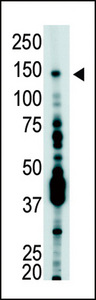 The anti-USP7 antibody is used in Western blot to detect USP7 in T-47D cell lysate.