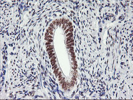 IHC of paraffin-embedded Human endometrium tissue using anti-USP7 mouse monoclonal antibody.