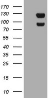 HEK293T cells were transfected with the pCMV6-ENTRY control (Left lane) or pCMV6-ENTRY USP7 (Right lane) cDNA for 48 hrs and lysed. Equivalent amounts of cell lysates (5 ug per lane) were separated by SDS-PAGE and immunoblotted with anti-USP7.