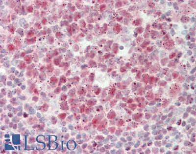 Human Tonsil: Formalin-Fixed, Paraffin-Embedded (FFPE)