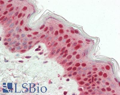 Human Skin: Formalin-Fixed, Paraffin-Embedded (FFPE)