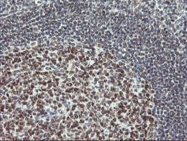 IHC of paraffin-embedded Human tonsil using anti-USP7 mouse monoclonal antibody. (Heat-induced epitope retrieval by 10mM citric buffer, pH6.0, 100C for 10min).