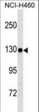 USP8 Antibody (C1072) western blot of NCI-H460 cell line lysates (35 ug/lane). The USP8 antibody detected the USP8 protein (arrow).