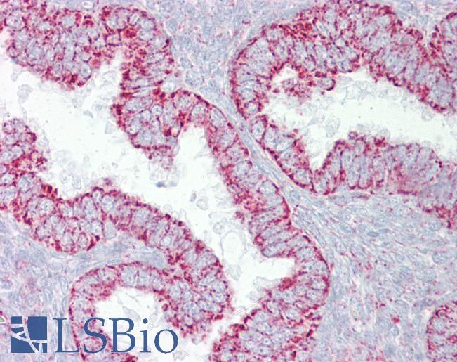 Anti-PDGFB antibody IHC of human uterus. Immunohistochemistry of formalin-fixed, paraffin-embedded tissue after heat-induced antigen retrieval. Antibody LS-B6945 concentration 5 ug/ml.