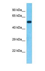 Western blot of VIPAS39 Antibody with Fetal Lung lysate.