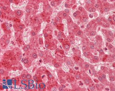 Human Liver: Formalin-Fixed, Paraffin-Embedded (FFPE)