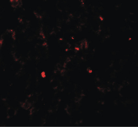Immunofluorescence of PDGF-B in human liver tissue with PDGF-B antibody at 20 ug/ml.