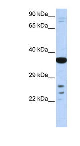 VSX1 antibody LS-C110088 Western blot of Fetal liver lysate.