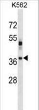 VSX1 Antibody western blot of K562 cell line lysates (35 ug/lane). The VSX1 antibody detected the VSX1 protein (arrow).