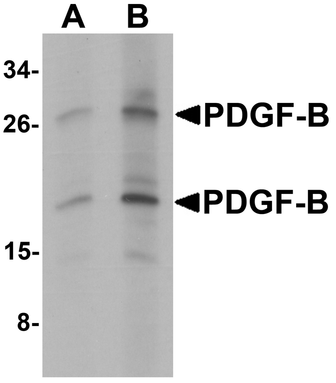 Western blot analysis of PDGF-B in rat liver tissue lysate with PDGF-B antibody at (A) 1 and (B) 2 ug/ml.