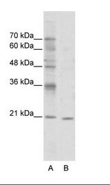 A: Marker, B: Jurkat Cell Lysate