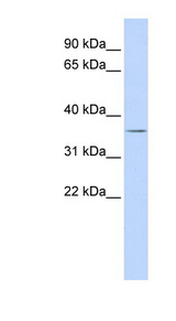 VSX1 antibody LS-C101578 Western blot of Fetal liver lysate.