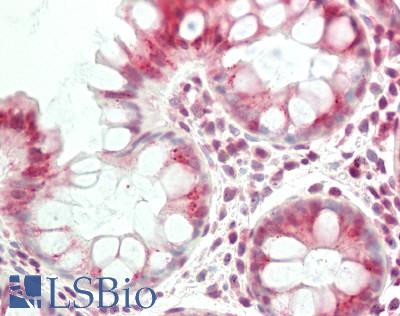 Human Colon: Formalin-Fixed, Paraffin-Embedded (FFPE)