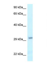 VTI1B antibody western blot of H226 Cell lysate. Antibody concentration 1 ug/ml.