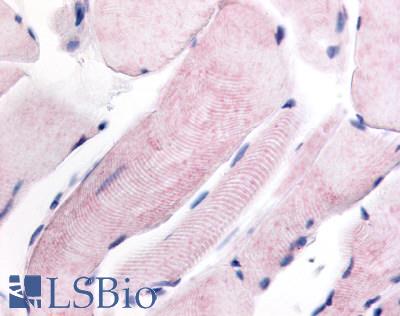 Anti-WNK1 antibody LS-A7484 IHC of human skeletal muscle. Immunohistochemistry of formalin-fixed, paraffin-embedded tissue after heat-induced antigen retrieval.