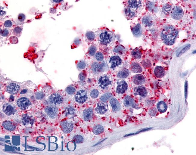 Anti-WNK1 antibody LS-A7494 IHC of human testis. Immunohistochemistry of formalin-fixed, paraffin-embedded tissue after heat-induced antigen retrieval.