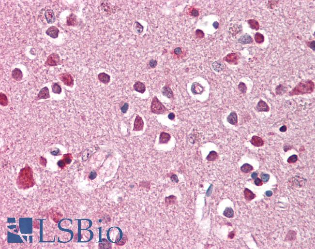 Anti-XAB2 / HCNP antibody IHC of human brain, cortex. Immunohistochemistry of formalin-fixed, paraffin-embedded tissue after heat-induced antigen retrieval. Antibody LS-B8287 dilution 3.75 ug/ml.