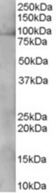 Antibody staining (0.3 ug/ml) of A431 lysate (RIPA buffer, 35 ug total protein per lane). Primary incubated for 1 hour. Detected by Western blot of chemiluminescence.