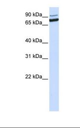 MCF7 cell lysate. Antibody concentration: 1.0 ug/ml. Gel concentration: 12%.